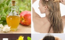 Home Remedies to Stop Dandruff