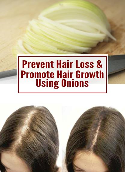 prevent-hair-loss-promote-growth-using-onions