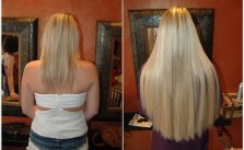 Before After Extensions